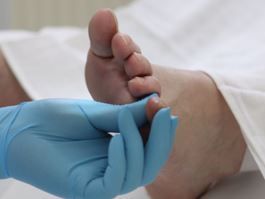 Detail van een nagelbehandeling bij Pedicurepraktijk Margriet